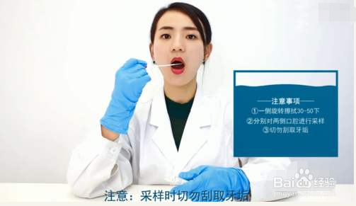 基因检测口腔粘膜采样流程