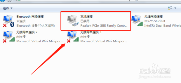 本地连接禁用了怎么恢复