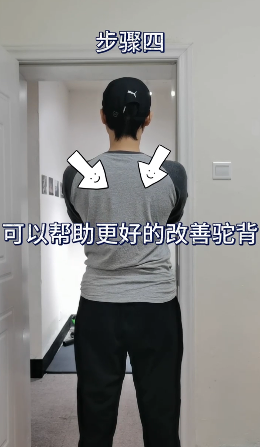 怎么改善驼背
