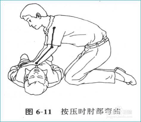 急救知识--心肺复苏