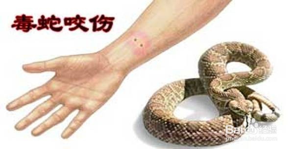 在野外被蛇咬伤怎么办？