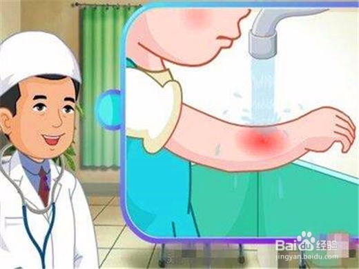 被狗咬了怎么办该如何处理