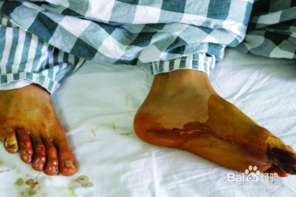 家中有人发生触电怎么办