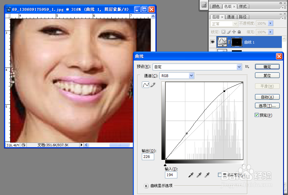 怎么将牙齿变得美白无暇