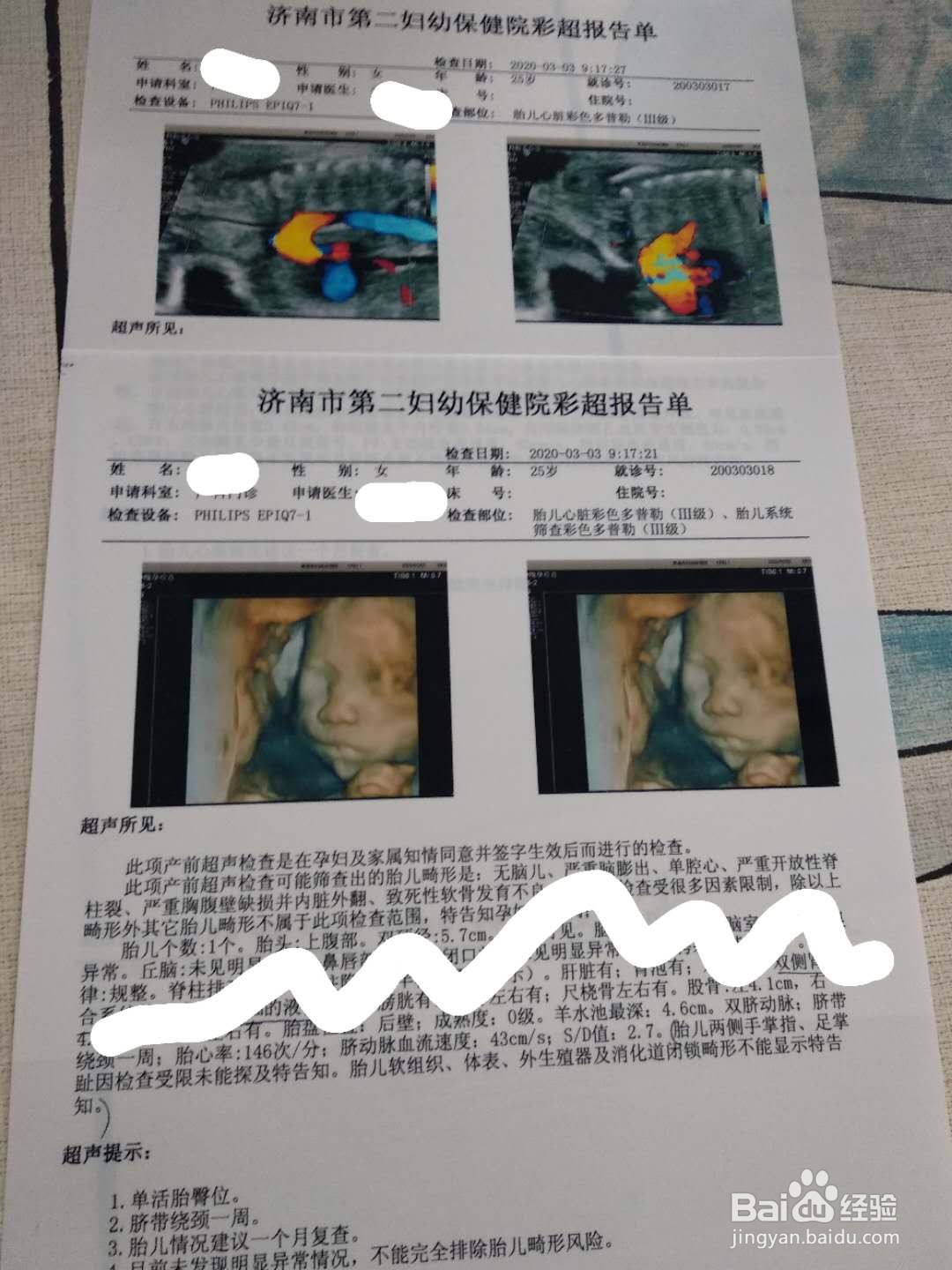 孕期产检内容及对应的时间表