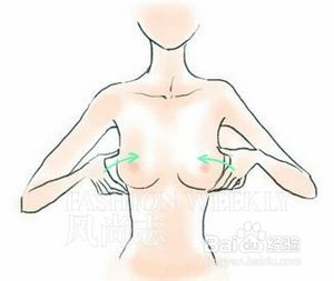 丰胸胸线提升法
