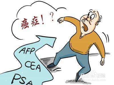 肾癌有哪些常见的转移部位