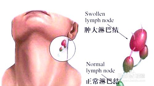 外伤伤口感染及处理