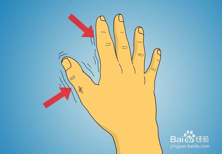 如何诊断拇指是否骨折?