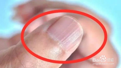 如何认知肝脏好的身体表现