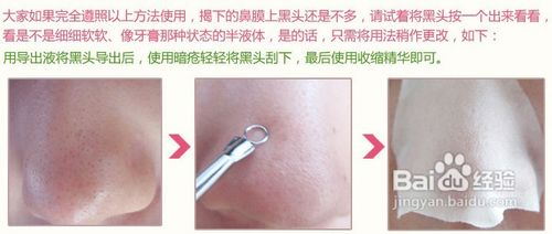 怎么才能去除黑头