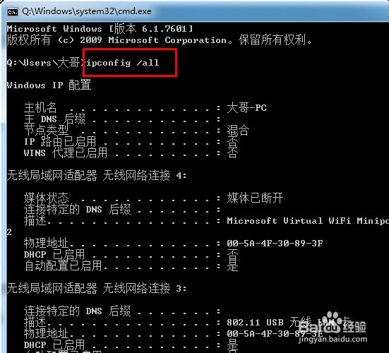电脑出现DNS错误无法上网怎么办