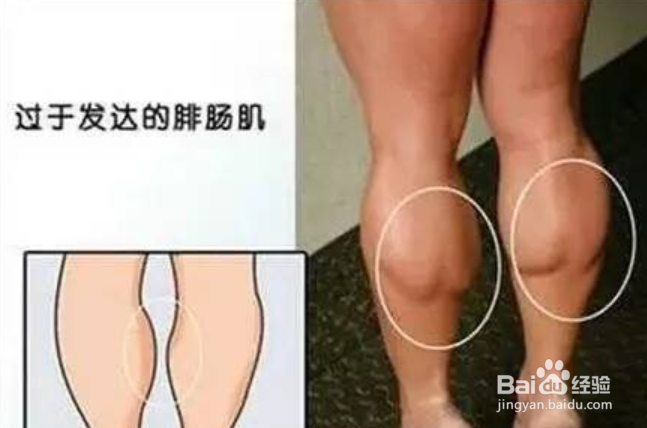怎样才能快速瘦腿