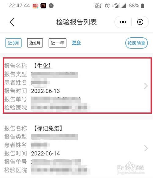 苏周到到哪查个人的医院检验报告