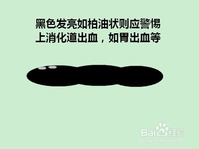 怎样根据大便及早发现健康隐患