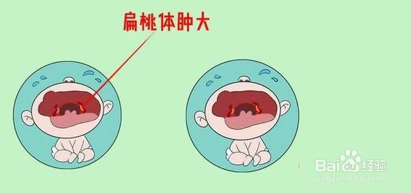 常见症状判断:低热