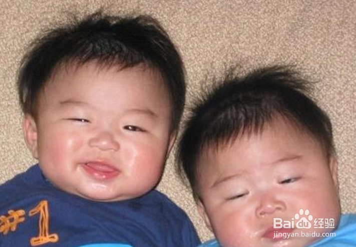 冬天腿部干痒怎么办