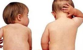 夏季长痱子,要如何护理?