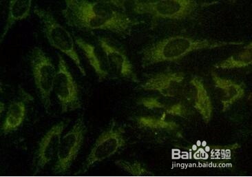 药物抗肿瘤细胞多药耐药相关研究技术