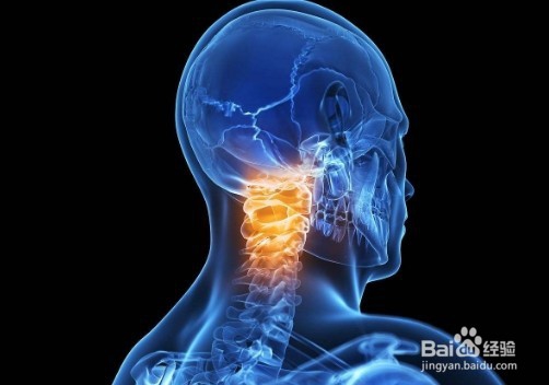 如何预防颈椎病