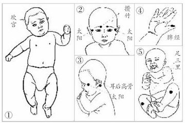 痉挛性斜颈是不是可以自愈？