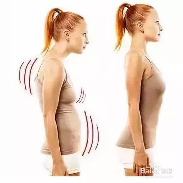 驼背最简单的自我矫正方法