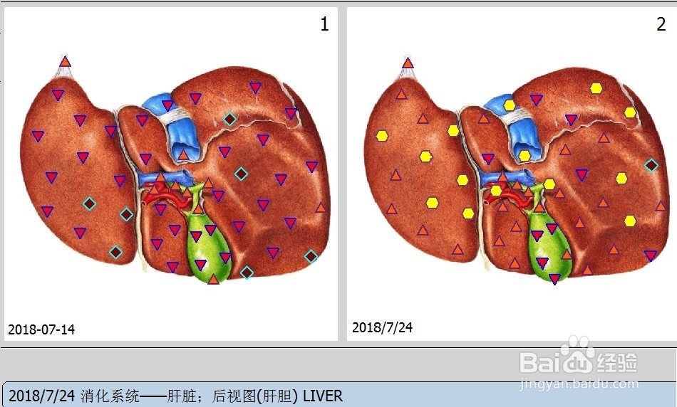 肝病那治的好, 吃保健品有用吗?
