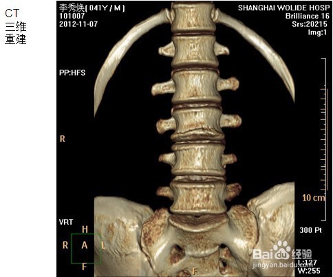单幅图像的三维场景重建方法
