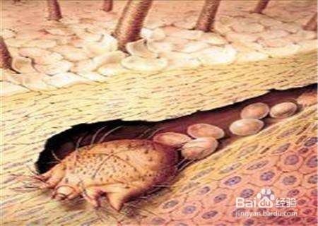 远离四样东西可以避免经常性掉头发