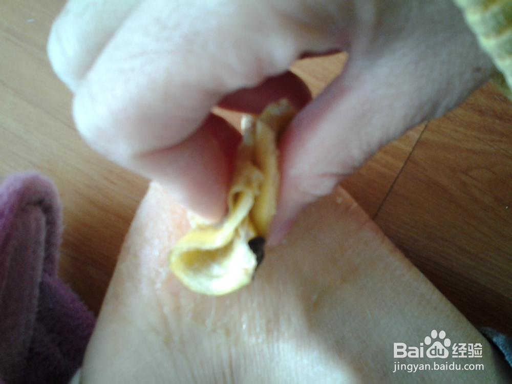 香蕉皮巧治皲裂