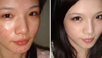 如何祛痘痘小编教你