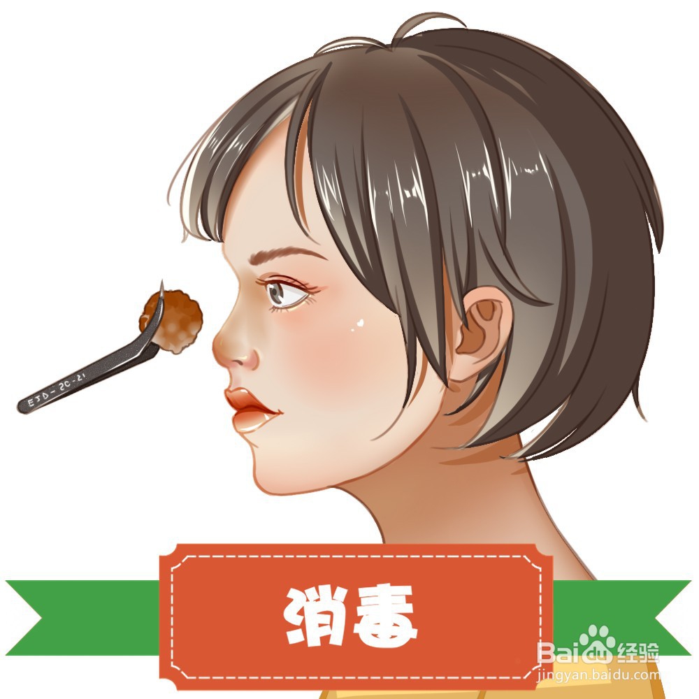 隆鼻手术过程