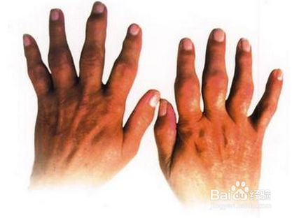 每个人都要知道的生活常识：[5]可怕的甜食