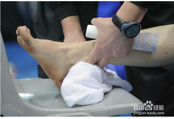 得了脚气怎么办_脚气怎么治疗