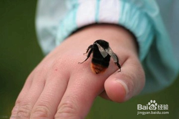 发生意外后,怎样急救?