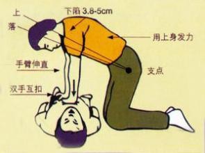触电急救“八字方针”