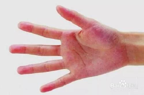 如何认知肝脏好的身体表现