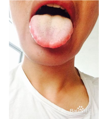 肝不好的人有什么特征