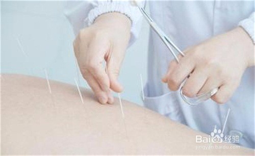 女生经常掉头发怎么办怎样保养