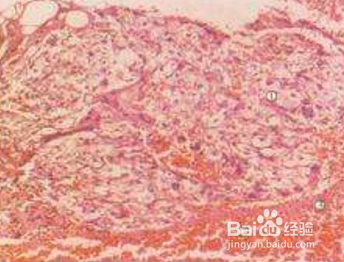 如何看囊胚等级