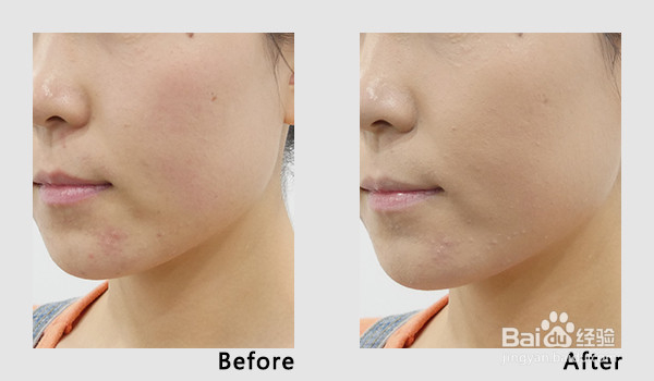 【bb霜和cc霜的区别】bb霜和cc霜的区别有哪些