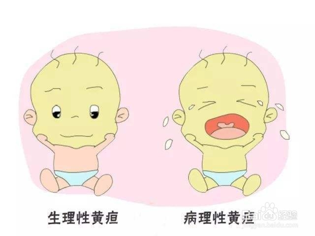 新生儿应该注意什么？