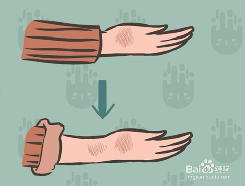 烫伤后的正确处理方法有哪些？