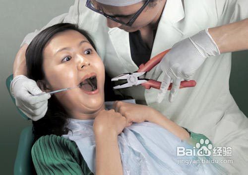 美白牙齿常见的五大误区有哪些？