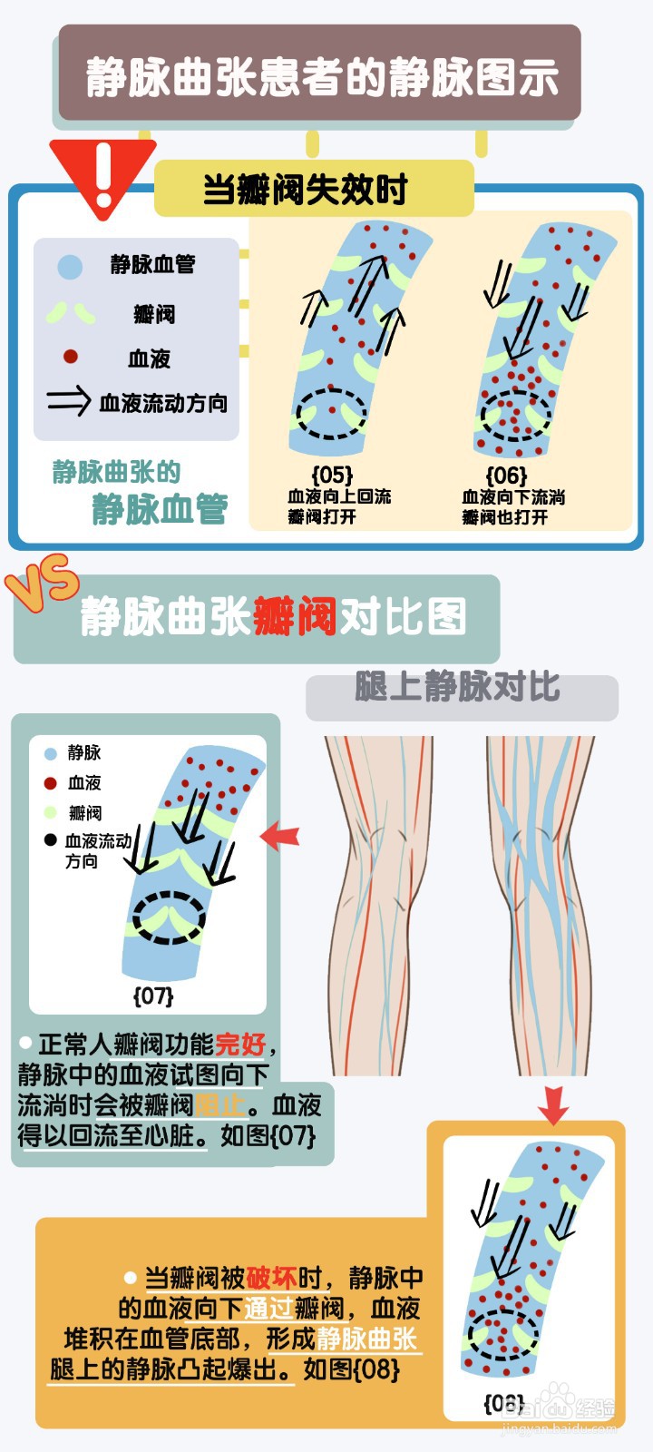 什么是静脉曲张有什么危害