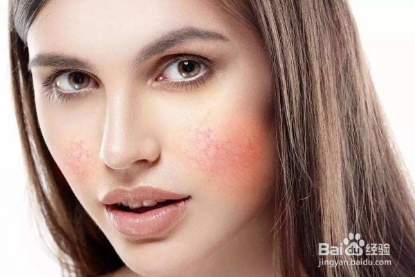 面部皮肤过敏怎么办