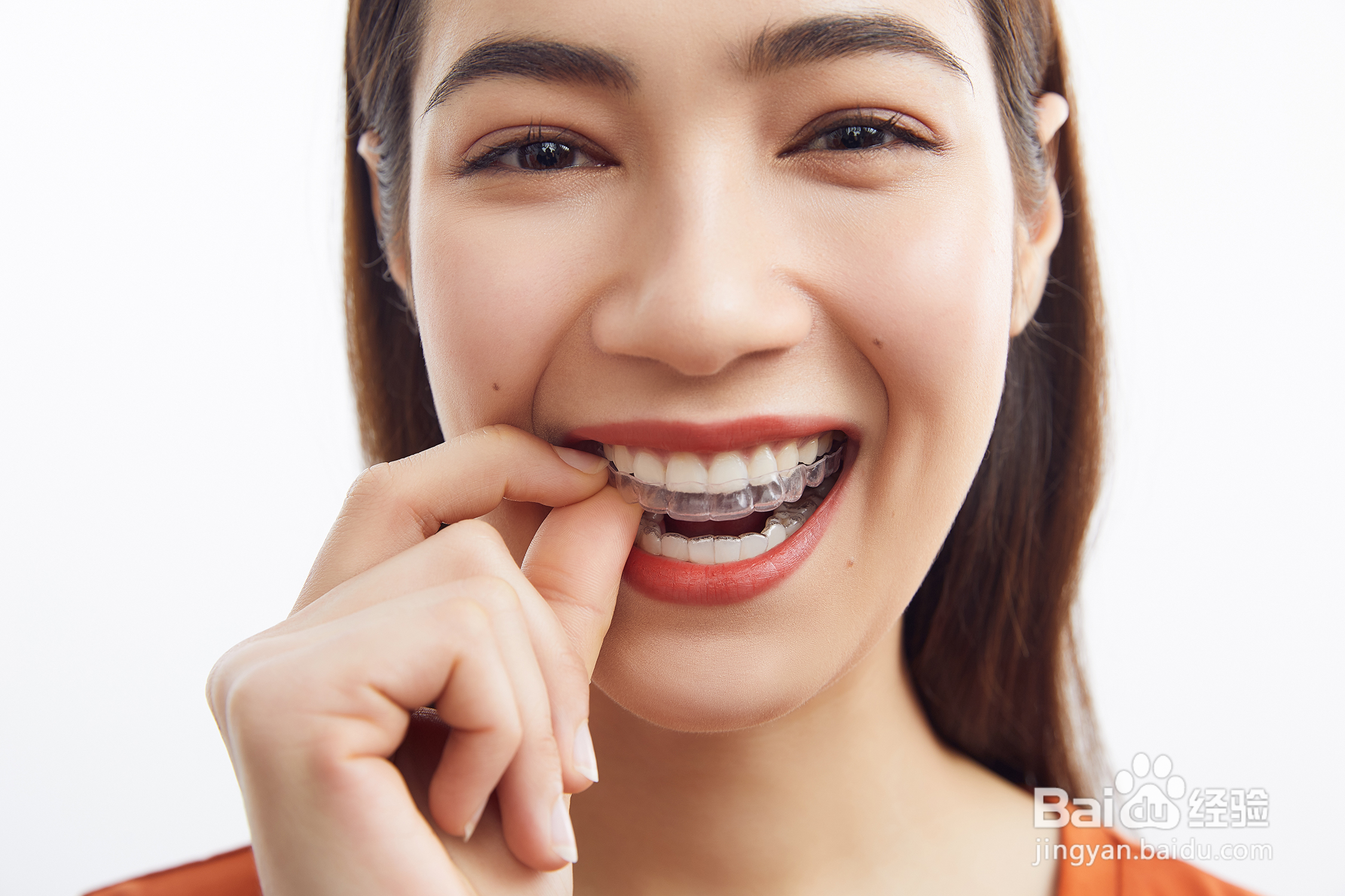 佩戴牙套需要注意什么?