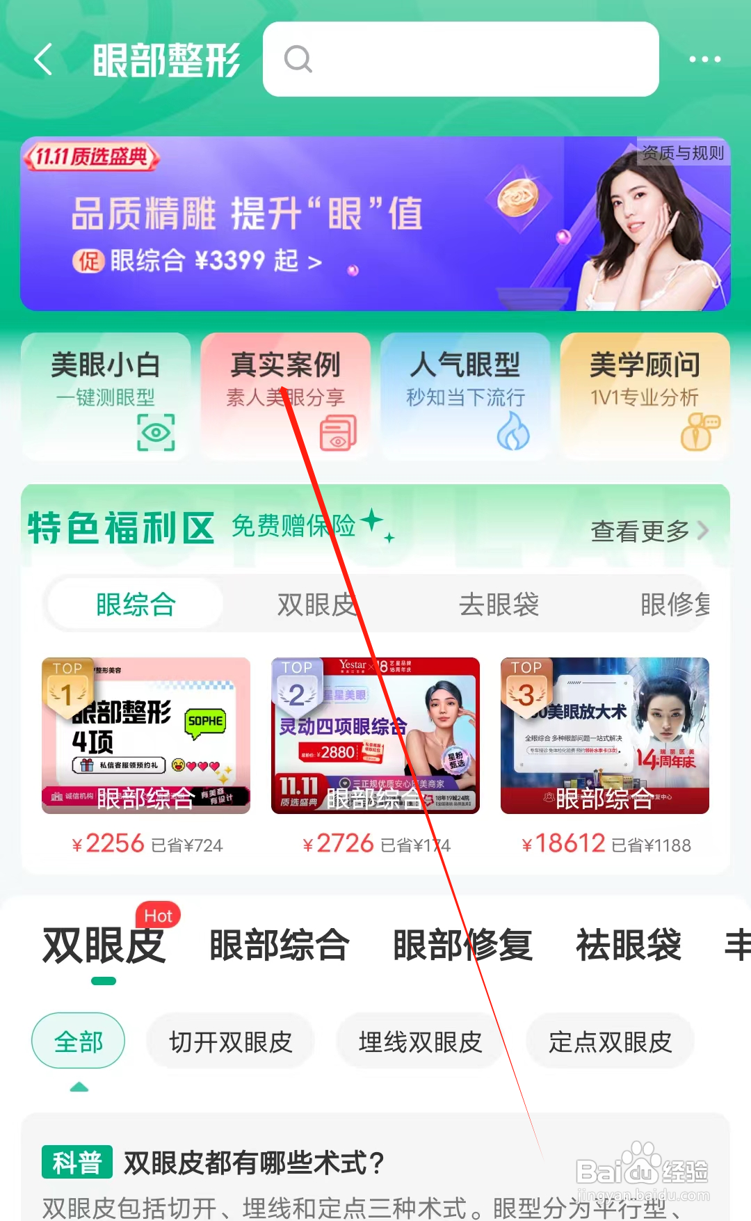 美问无忧怎样查看真实案例