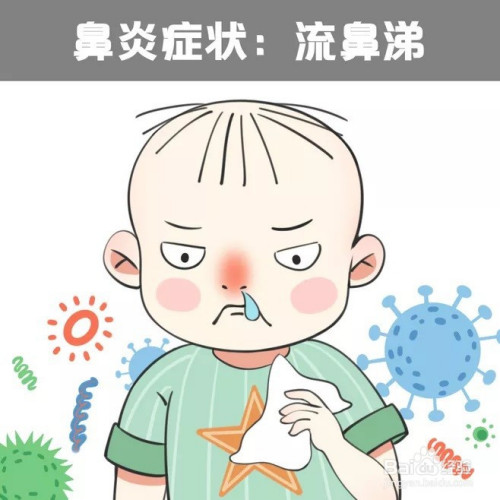 鼻炎症状图片