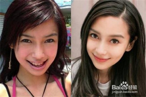 孙杨整牙之后居然撞脸王凯!盘点整过牙的明星们